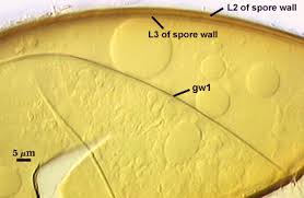 Attēlu rezultāti vaicājumam “Fuligo laevis spores”