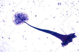 Attēlu rezultāti vaicājumam “Comatricha elegans”