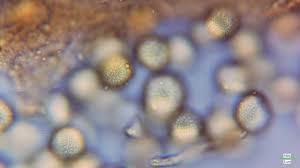 Attēlu rezultāti vaicājumam “Perichaena corticalis sessile”