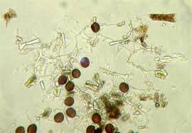 Attēlu rezultāti vaicājumam “Leocarpus fragilis spores”