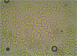 Attēlu rezultāti vaicājumam “Erythricium aurantiacum”