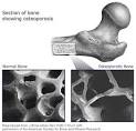 Nutrition for Everyone: Basics: Calcium and Bone Health | DNPAO | CDC