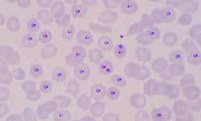 Attēlu rezultāti vaicājumam “Diderma cingulatum plasmodium”