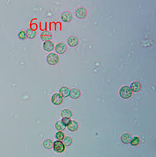 Attēlu rezultāti vaicājumam “Lycogala fuscoolearium young”