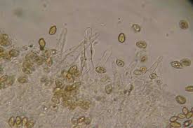 Attēlu rezultāti vaicājumam “Galerina marginata”