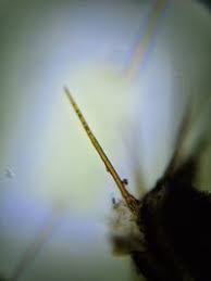 Attēlu rezultāti vaicājumam “Cheilymenia stercorea”