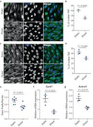 Image result for backmodel terzi