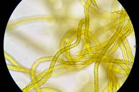 Attēlu rezultāti vaicājumam “Oligonema persimile macro”