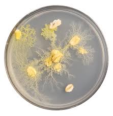 Attēlu rezultāti vaicājumam “Physarum contextum spores”