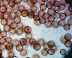 Attēlu rezultāti vaicājumam “Diderma effusum”