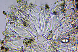 Attēlu rezultāti vaicājumam “Megalaria grossa”
