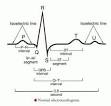 electrocardiogram - definition of electrocardiogram in the Medical ...