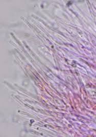 Attēlu rezultāti vaicājumam “Hyaloscypha hyalina”