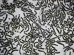 Attēlu rezultāti vaicājumam “Biscogniauxia marginata”