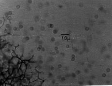 Attēlu rezultāti vaicājumam “Stemonitopsis aequalis var. microspora spores”