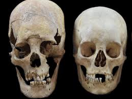Image result for elongated skulls