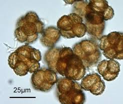 Attēlu rezultāti vaicājumam “Tortula truncata sporophyte”