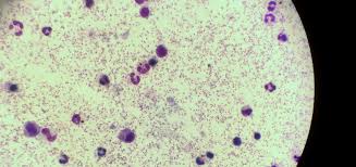 Attēlu rezultāti vaicājumam “Reticularia lobata plasmodium”