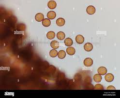 Attēlu rezultāti vaicājumam “Badhamia foliicola sessile”