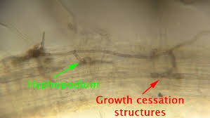 Attēlu rezultāti vaicājumam “Lophozia badensis sporophyte”