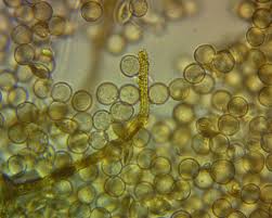 Attēlu rezultāti vaicājumam “Arcyria helvetica young”