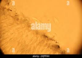 Attēlu rezultāti vaicājumam “Cudoniella acicularis”