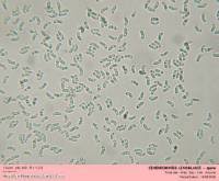 Attēlu rezultāti vaicājumam “Cinereomyces lindbladii”