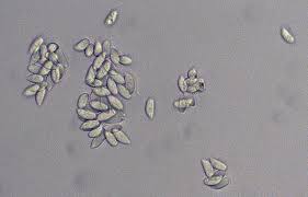 Attēlu rezultāti vaicājumam “Badhamia bethelii spores”