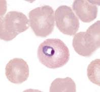 Attēlu rezultāti vaicājumam “Diderma radiatum plasmodium”