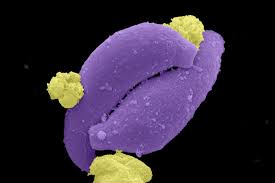 Attēlu rezultāti vaicājumam “Diderma umbilicatum plasmodium”