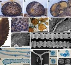 Attēlu rezultāti vaicājumam “Lycogala convexum”