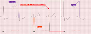 Image result for  ^ L V [ h    