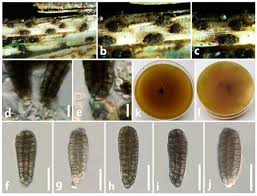 Attēlu rezultāti vaicājumam “Diachea dictyospora (syn. Craterium dictyosporum) spores”