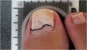 Image result for lunula nail