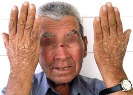 Image result for Lewandowsky-Lutz