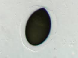 Attēlu rezultāti vaicājumam “Sordaria fimicola”