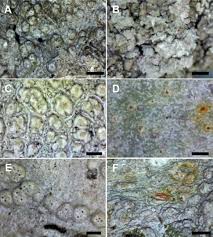 Attēlu rezultāti vaicājumam “Pertusaria albescens”