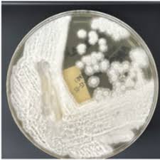 Attēlu rezultāti vaicājumam “Sanionia uncinata  sporophyte”