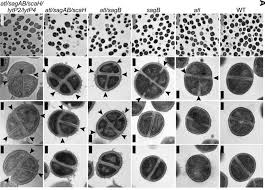 Attēlu rezultāti vaicājumam “Dicranella staphylina cells”