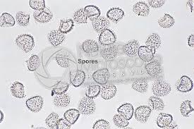 Attēlu rezultāti vaicājumam “Lignydium muscorum spores”