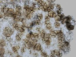 Attēlu rezultāti vaicājumam “Lycogala cf. fossiculatum young”