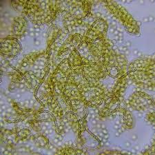 Attēlu rezultāti vaicājumam “Trichia sp.”