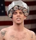 Jackass prankster Steve-O