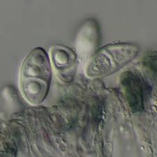 Attēlu rezultāti vaicājumam “Megalaria grossa”