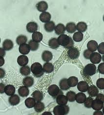 Attēlu rezultāti vaicājumam “Physarum straminipes young”