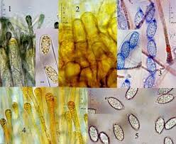 Attēlu rezultāti vaicājumam “Melastiza chateri”