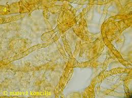 Attēlu rezultāti vaicājumam “Trichia contorta”