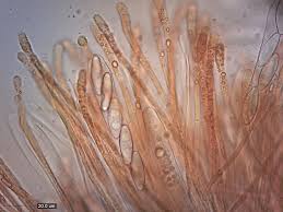 Attēlu rezultāti vaicājumam “Byssonectria fusispora”