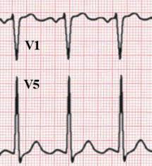 Image result for  ^ L V [ h    