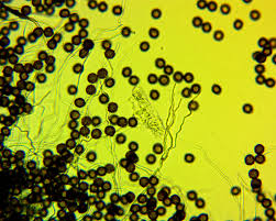 Attēlu rezultāti vaicājumam “Diderma spumarioides”